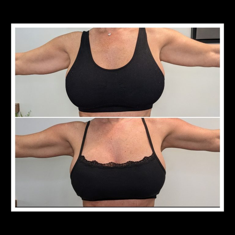 800x800 b4 and after cryo website (18)