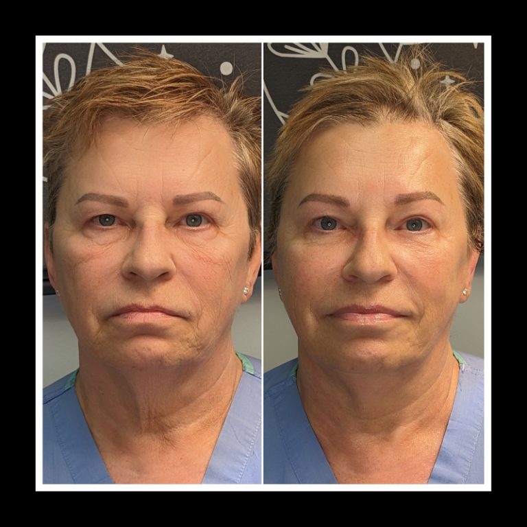 800x800 b4 and after cryo website (20)